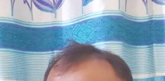 होम्योपैथी: जड़ से इलाज, प्राकृतिक उपचार।